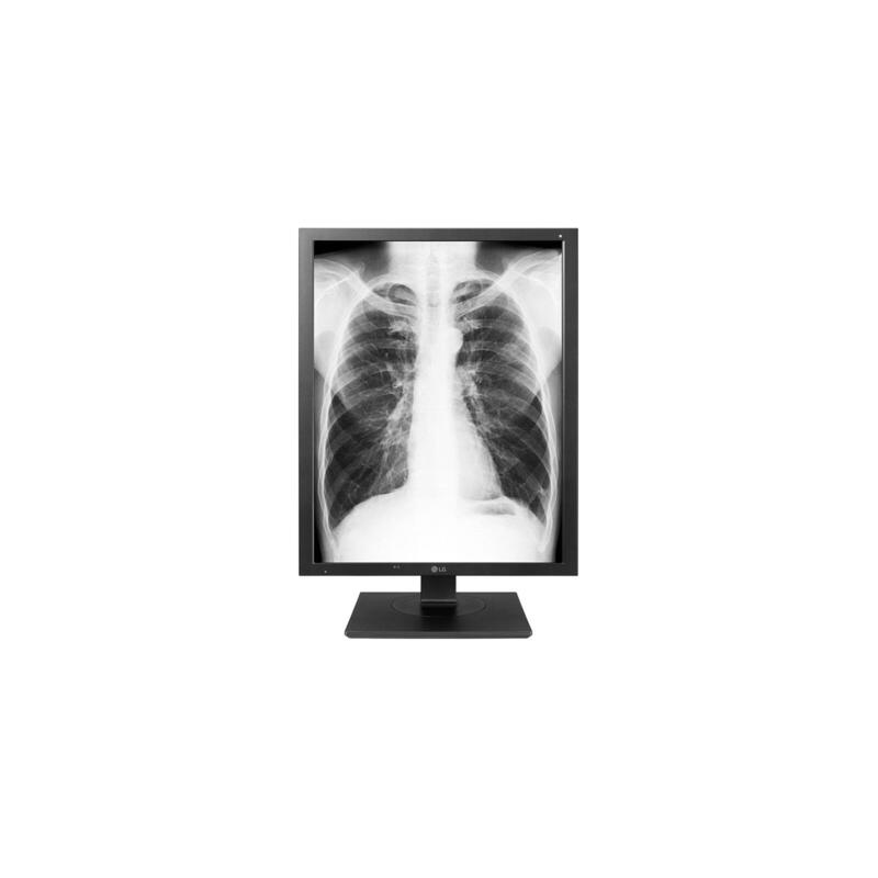 lg-21hk512d-monitor-led-3mp-escala-de-gris-213-2048-x-1536-60-hz-ips-1000-cdm-14001-30-ms-dvi-d-displayport-antracita