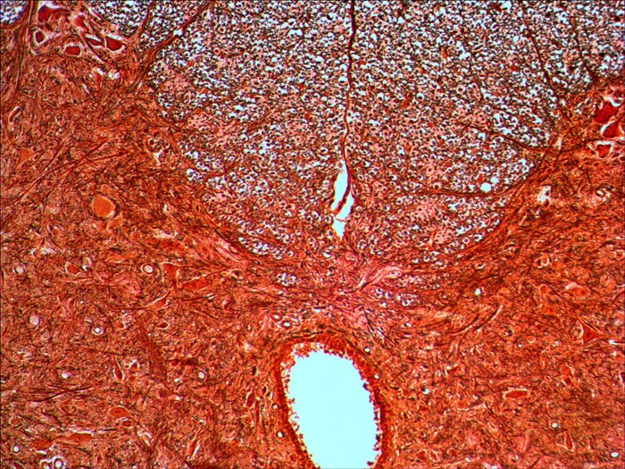 Levenhuk N20 Ng Vidrio Portaobjetos De Microscopio
