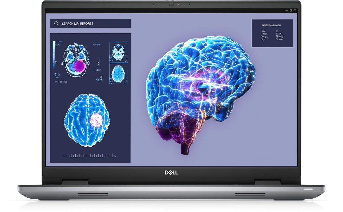 EAN 5397184810408 - DELL Precision 7680 Intel® Core™ i7 i7-13850HX Estación de trabajo móvil 40,6 cm (16") Full HD+ 32 GB DDR imagen 1